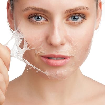 Những điều tuyệt đối nên tránh khi da đang bị mụn 5 Nên tránh khi da đang bị mụn: