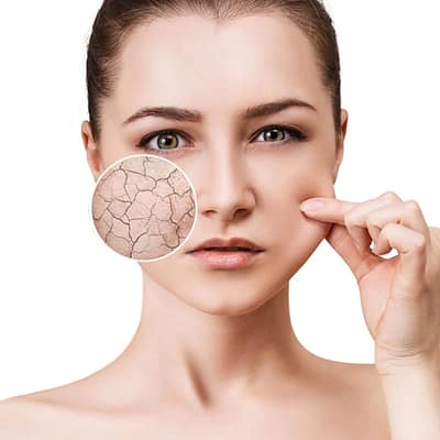 Điều trị nám da Liệu trình trị nám