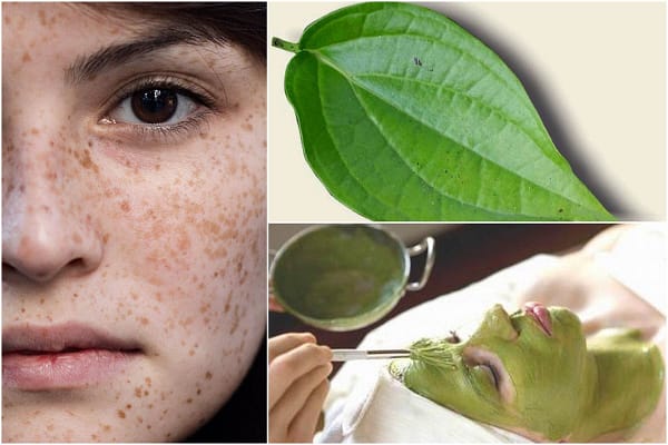 Nguy cơ hỏng da với cách điều trị nám vùng má từ lá trầu không, chưa chắc "thần thánh" như lời đồn 5 xoa-mo-nam-sang-lan-da-hon-khi-kien-tri-dap-mat-na-voi-la-trau-khong-1