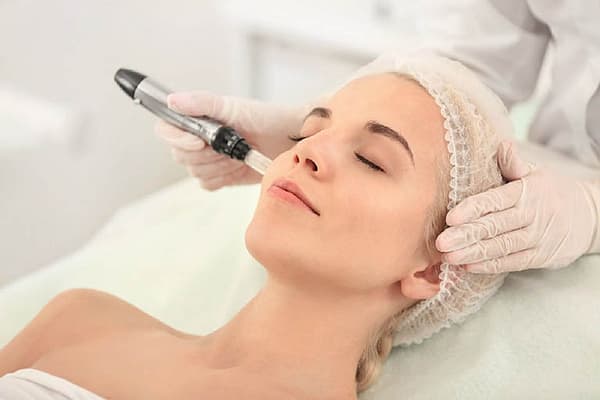 Trị mụn bằng tia Laser có hiệu quả nhanh không? 7 Trị mụn bằng tia Laser cho hiệu quả tức thì, phục hồi nhanh