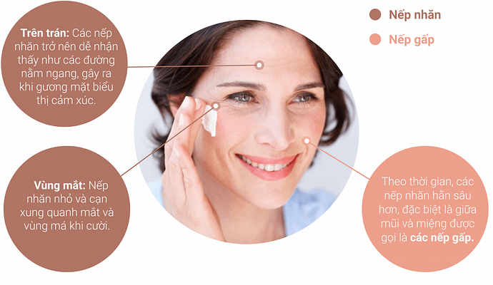 Nâng cơ mặt không phẫu thuật nghỉ dưỡng có lâu không, Thời gian hồi phục bao lâu? 5 nang-co-khong-phau-thuat-giup-day-lui-cac-dau-hieu-cua-lao-hoa