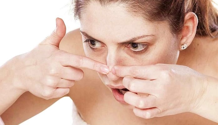 Chăm sóc da mặt - Đâu là quy trình hoàn hảo nhất? 10 Đối với những trường hợp mụn nghiêm trọng, cần phải điều trị nghiêm túc