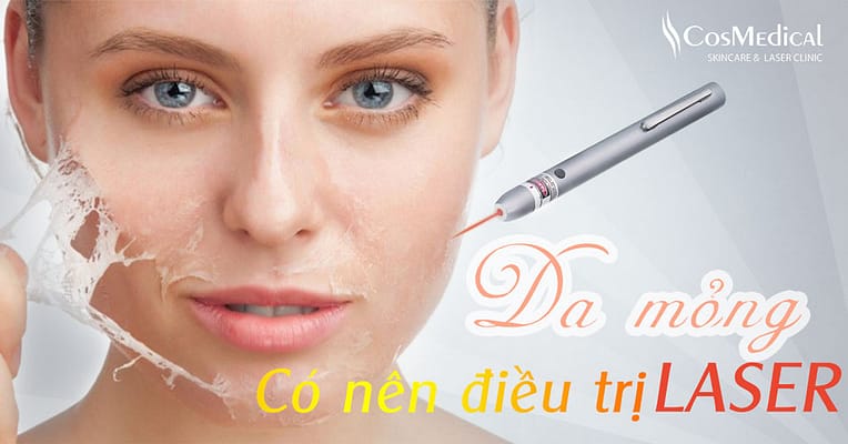 【HỎI ĐÁP】 DA MỎNG VÀ YẾU CÓ NÊN ĐIỀU TRỊ NÁM BẰNG LASER? 2 da mỏng có nên điều trị nám bằng laser