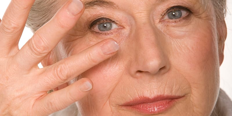 3 công nghệ không phẫu thuật xoá nếp nhăn hiệu quả nhất? 5 thermage-giup-ban-xoa-nep-nhan-hieu-qua-nhung-kha-ton-chi-phi-22