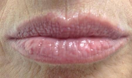 LIP BENEFITS 9 duoc-my-pham-cosmedical-usa-lip-after-4
