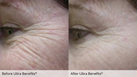 AGE REVERSE SYSTEM (Nhỏ) 6 duoc-my-pham-cosmedical-usa-ultra-benefits