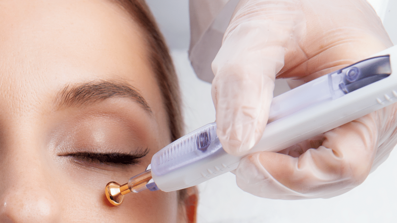 Event Xóa Nhăn 24 Khách hàng trải nghiệm dịch vụ xóa nhăn, nâng cơ Rada vàng & Quang xung kích tại CosMedical Clinic