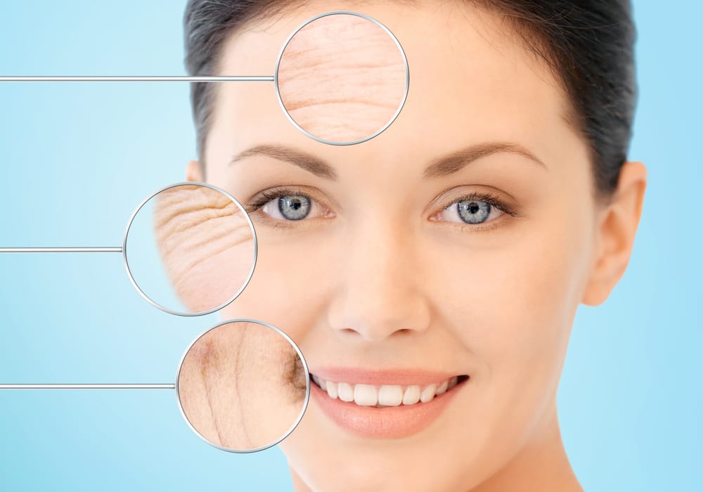 LIỆU PHÁP XÓA NHĂN NHƯ BOTOX 18 dich vu xoa nhan vung tran khoe mieng duoi mat